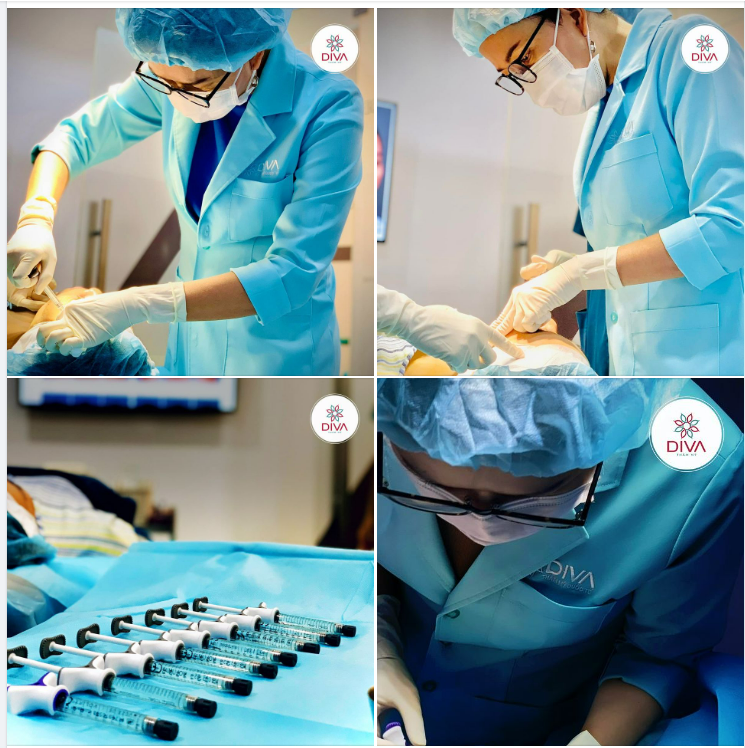 TẠI SAO FILLER MD CODES MANG LẠI HIỆU QUẢ CAO TRONG VIỆC ĐIỀU TRỊ CHẢY XỆ KHUÔN MẶT