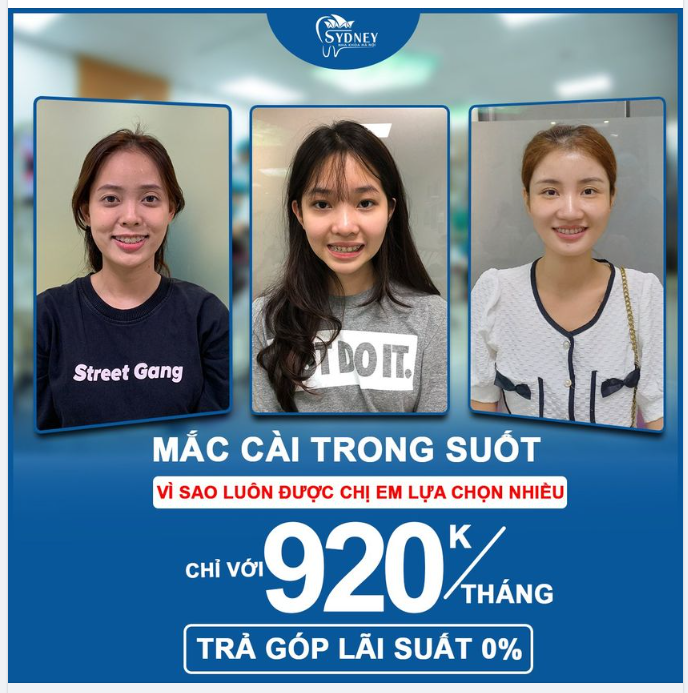 TẠI SAO MẮC CÀI TRONG SUỐT LUÔN ĐƯỢC CHỊ EM LỰA CHỌN NHIỀU KHI NIỀNG RĂNG?