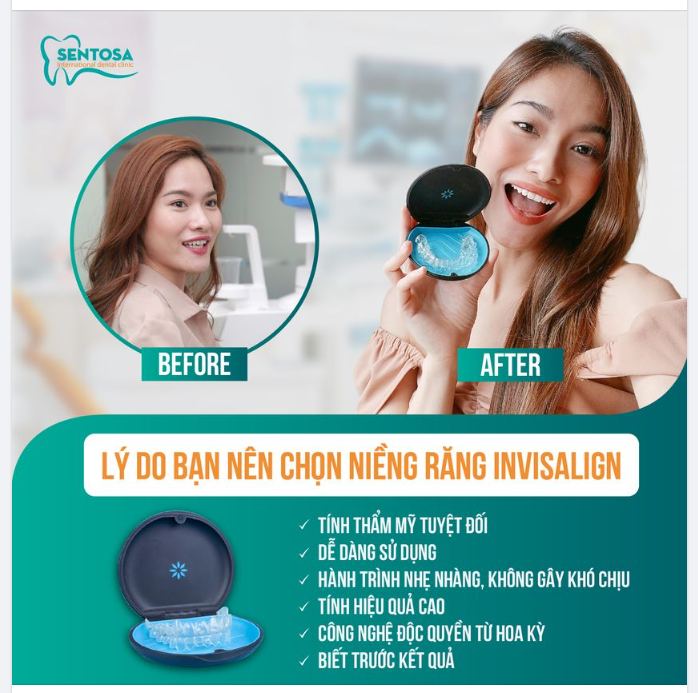 TẠI SAO NIỀNG RĂNG INVISALIGN ĐANG ĐƯỢC NHIỀU KHÁCH HÀNG LỰA CHỌN