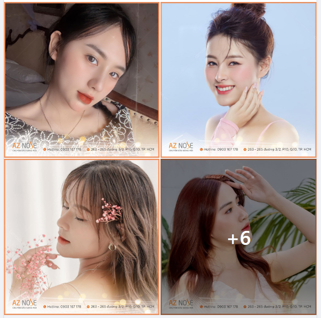 Tại sao sụn Surgiform được ưa chuộng trong nâng mũi thẩm mỹ