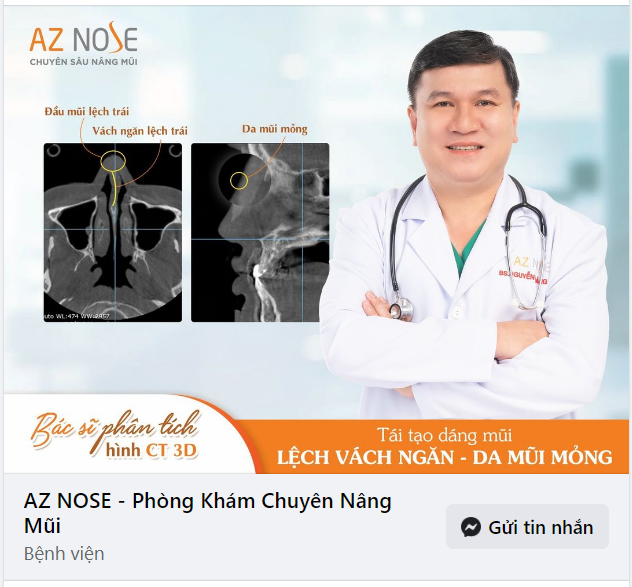 Tái tạo mũi lệch - da m.ỏng cho khách hàng Cần Thơ