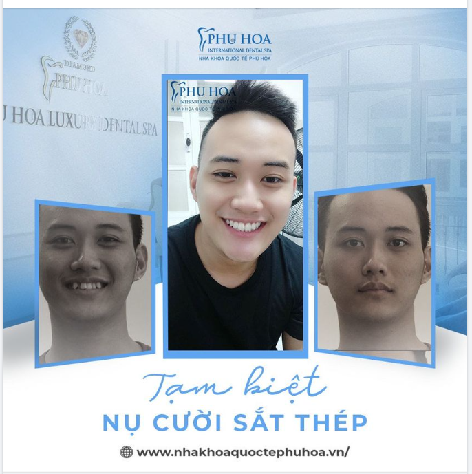 TẠM BIỆT “NỤ CƯỜI SẮT THÉP”