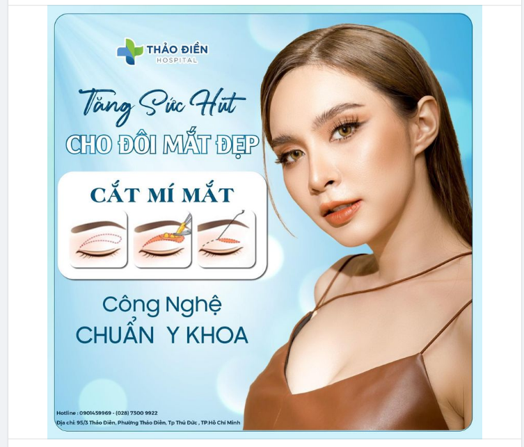 TĂNG SỨC HÚT CHO ĐÔI MẮT ĐẸP - CẮT MẮT 2 MÍ