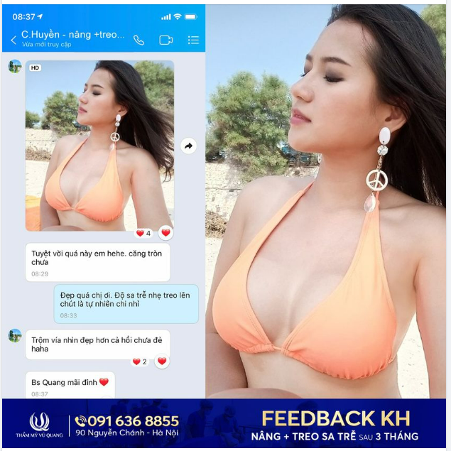 TEO LÉP THÌ NÂNG LÊN - CHẢY XỆ THÌ TREO NGAY!