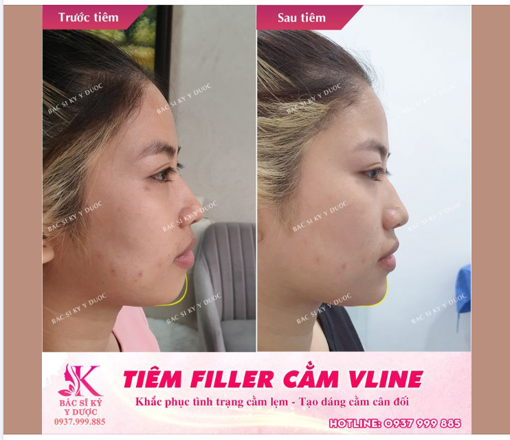 THẨM MỸ NỘI KHOA - LÀM ĐẸP KHÔNG CẦN PHẪU THUẬT
