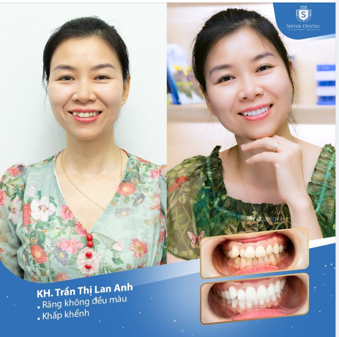 THAY DIỆN MẠO MỚI - ĐẸP KHÔNG CHỜ ĐỢI