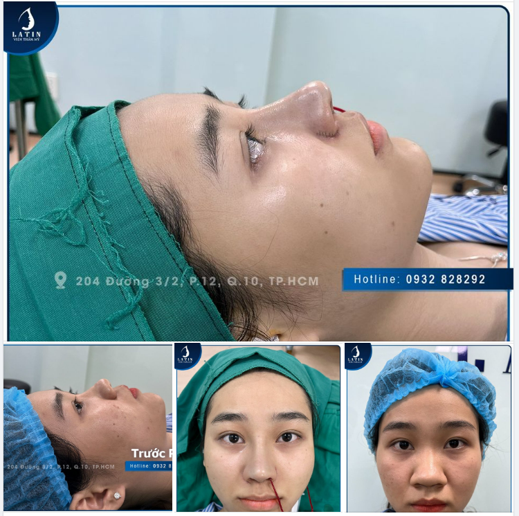 Thay đổi diện mạo - Tự tin cả đời