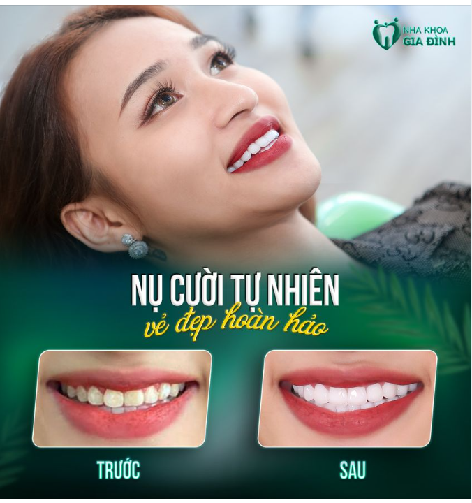 THAY ĐỔI MÀ RĂNG ĐẸP THẾ NÀY PHẢI ĐI LÀM NGAY THÔI!!!