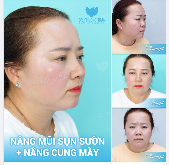 Thay vì cứ ngồi tiếc, Sao không thử một lần, Làm mới và thay đổi. Chắc chắn sẽ thành công…!