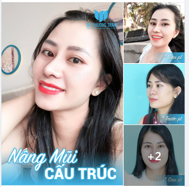 Thế giới ồn ào quá Vậy vào tim em đi…!