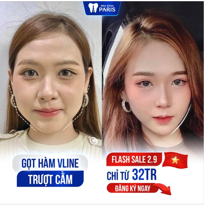 Thon gọn hàm tạo Góc nghiêng thần thánh