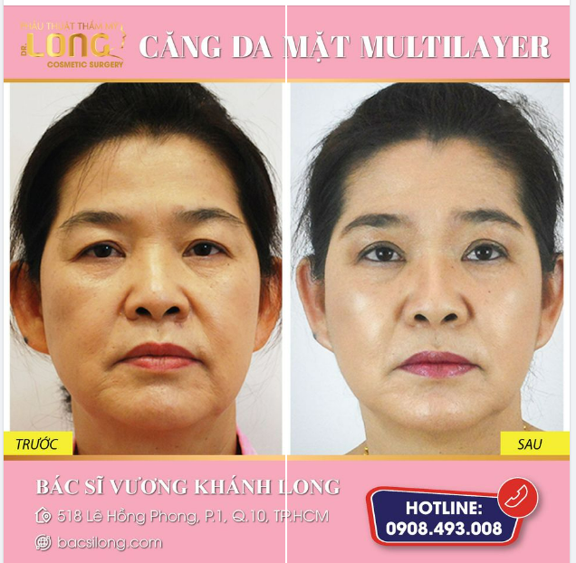 Thực hiện ngay giải pháp giúp làn da căng đầy trẻ hóa chỉ sau 60 phút hiệu quả bất ngờ