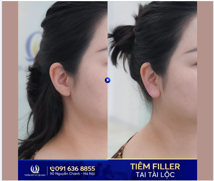 Tiêm Tai Tài Lộc - Đổi Phong Thuỷ, Rước Phú Quý