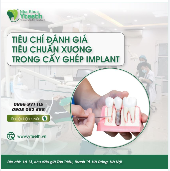 TIÊU CHÍ ĐÁNH GIÁ TIÊU CHUẨN XƯƠNG TRONG CẤY GHÉP IMPLANT