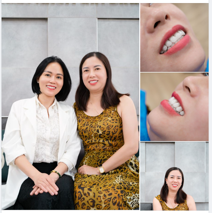 TÌM LẠI BẦU TRỜI THANH XUÂN VỚI NỤ CƯỜI ĐẸP KHÔNG TÌ VẾT