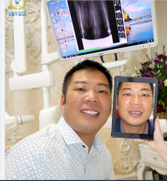 Tìm lại nụ cười phong độ cho khách hàng thân yêu