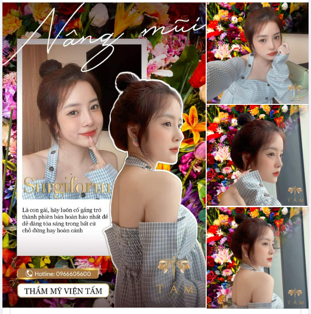 Toả sáng xinh đẹp với nâng mũi Surgiform