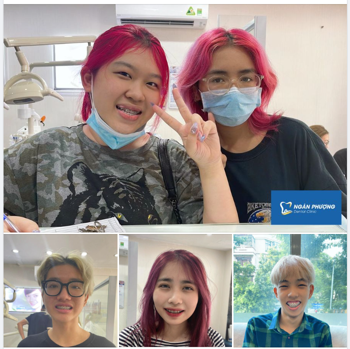 Tóc không máu lửa đời không nể. Khách niềng nhà Ngân Phượng cháy quá