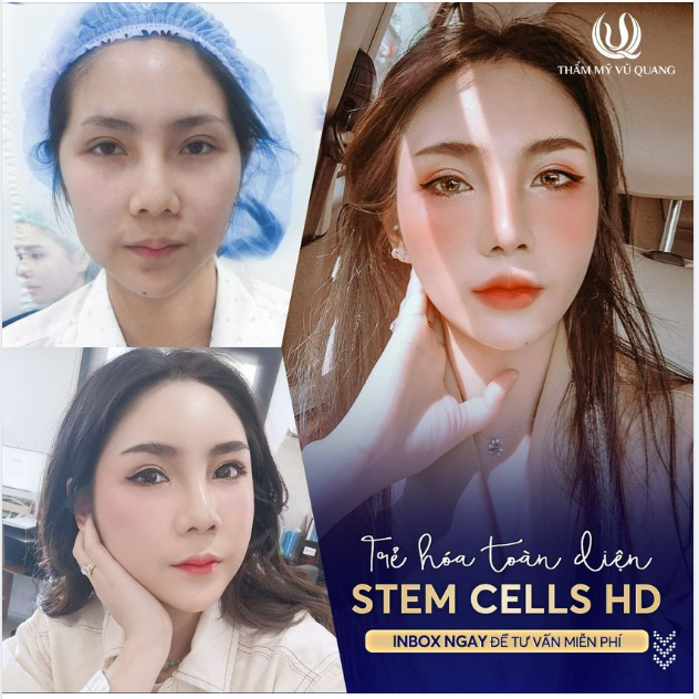 Trẻ hơn tuổi thật là ao ước của mọi cô gái...