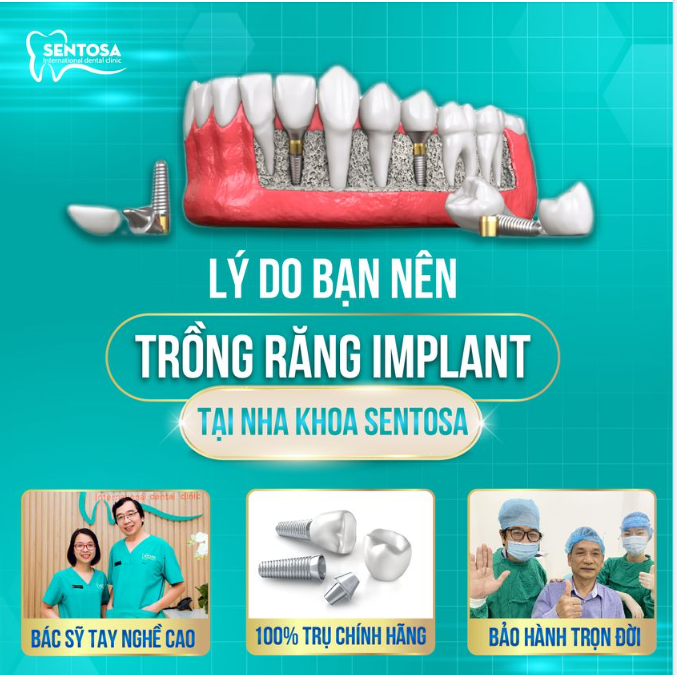 TRỒNG RĂNG IMPLANT - TẠI SAO BẠN NÊN CHỌN NHA KHOA SENTOSA
