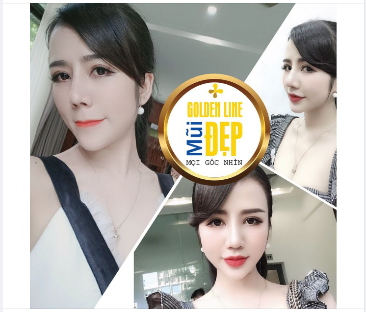 TRƯỜNG HỢP NÀO NÊN CHỌN NÂNG MŨI GOLDEN LINE ️