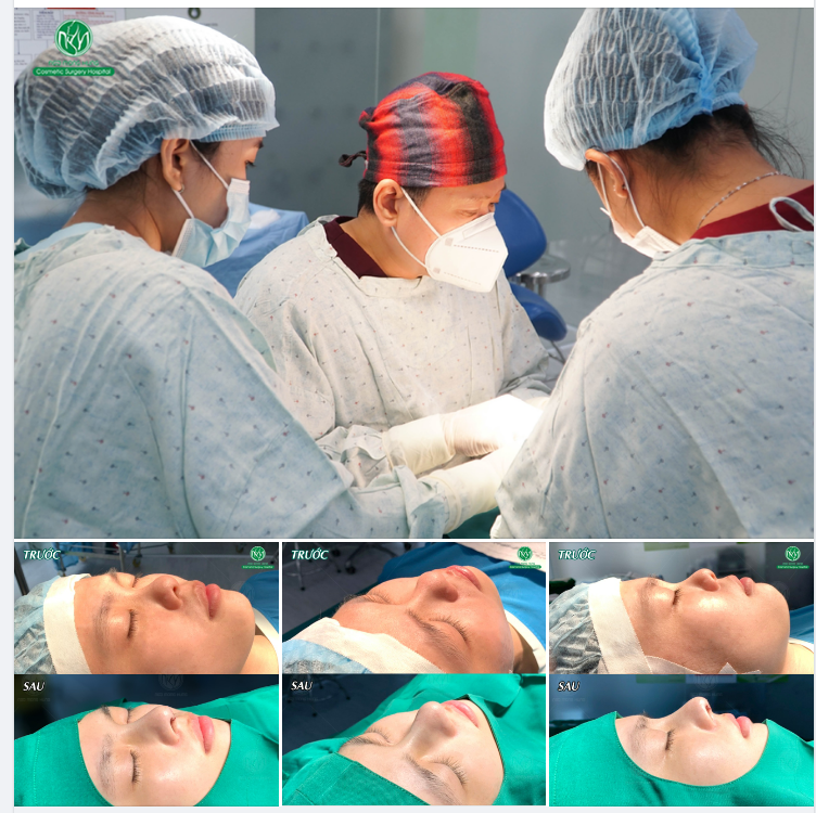 VẪN LÀ DÁNG MŨI S LINE CAO THANH THOÁT