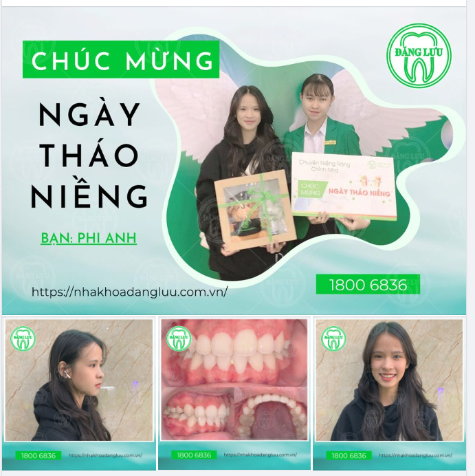 Vì nụ cười thiện cảm chính là cầu nối cho mọi mối quan hệ thêm gần gũi.