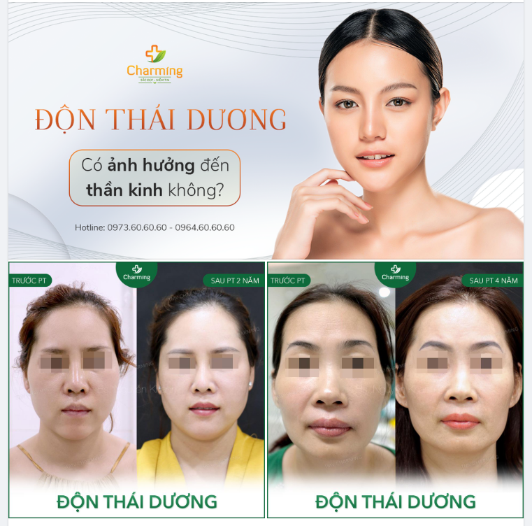 VỊ TRÍ NÀO ĐẶT MIẾNG ĐỘN THÁI DƯƠNG ĐỂ KHÔNG ẢNH HƯỞNG DÂY THẦN KINH