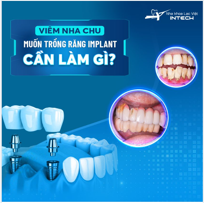 VIÊM NHA CHU MUỐN TRỒNG RĂNG IMPLANT CẦN LÀM GÌ?