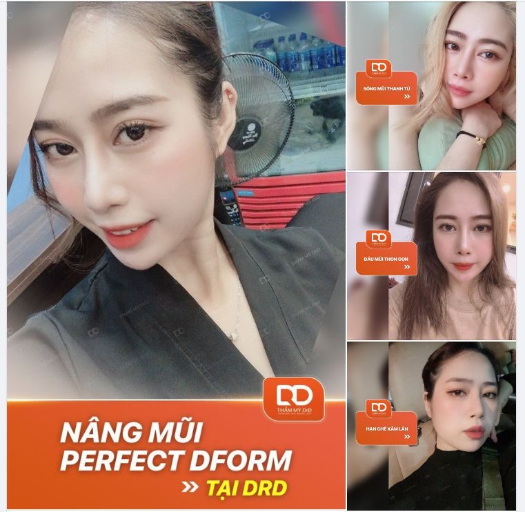 Với bạn, một dáng mũi đẹp là dáng mũi như thế nào