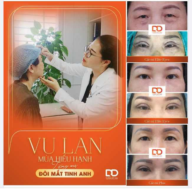 Vu lan về con cài lên ngực Bông hồng vàng báo hiếu mẹ cha