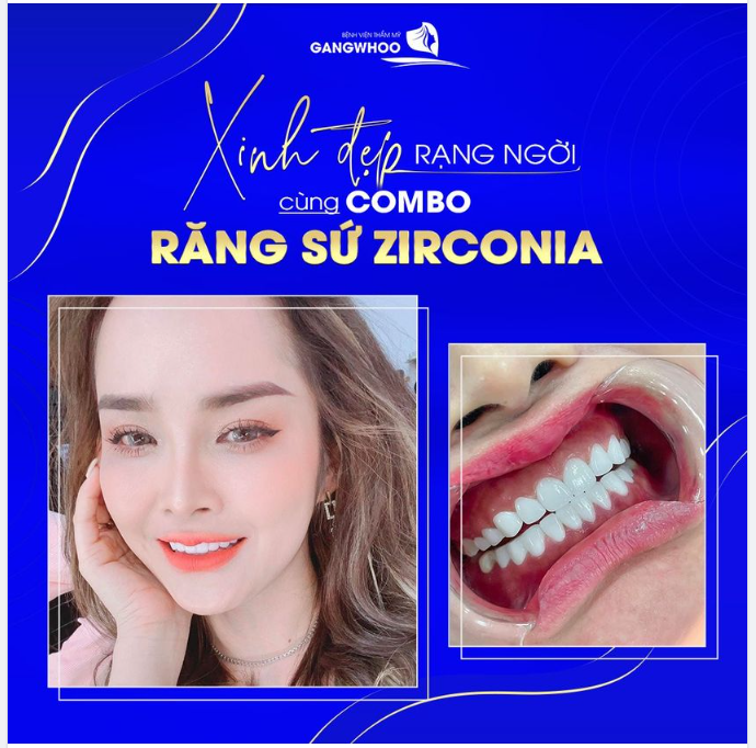 XINH ĐẸP RẠNG NGỜI CÙNG COMBO RĂNG SỨ ZIRCONIA