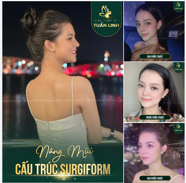 XINH, SANG VÀ TÂY HƠN SAU NÂNG MŨI