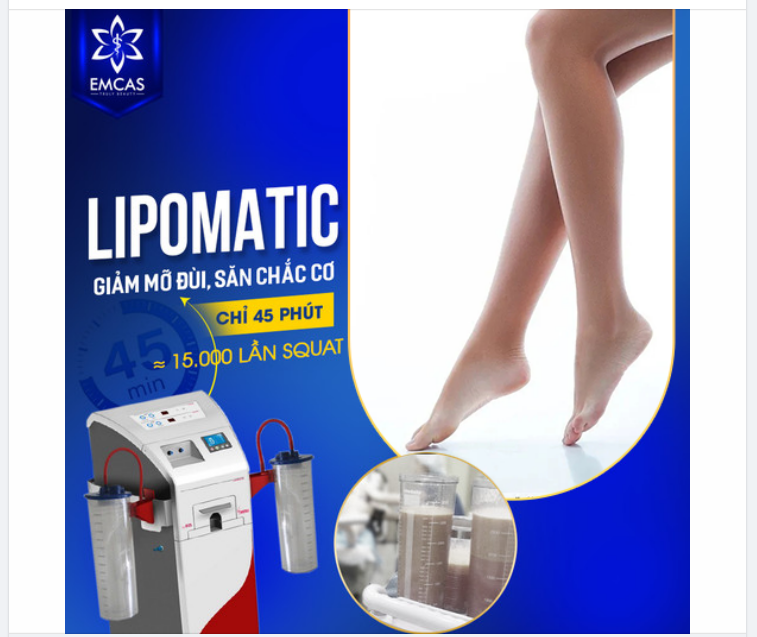 XÓA CHÂN TO, ĐÙI ẾCH ĐƠN GIẢN VỚI LIPOMATIC