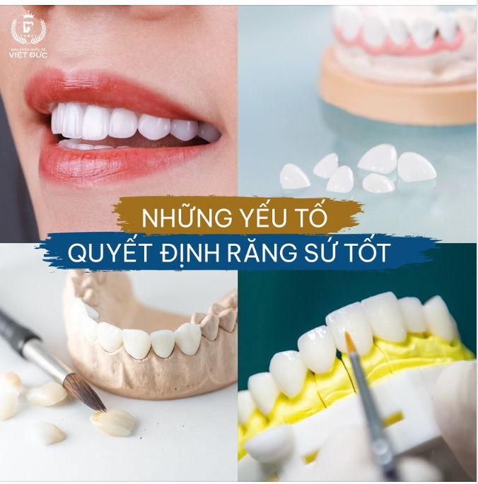 YẾU TỐ QUYẾT ĐỊNH MỘT CHIẾC RĂNG SỨ TỐT
