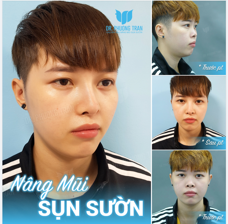 ​​​​​​​10 ĐIỂM CHO VẺ ĐẸP PHI GIỚI TÍNH XUẤT SẮC NÀY