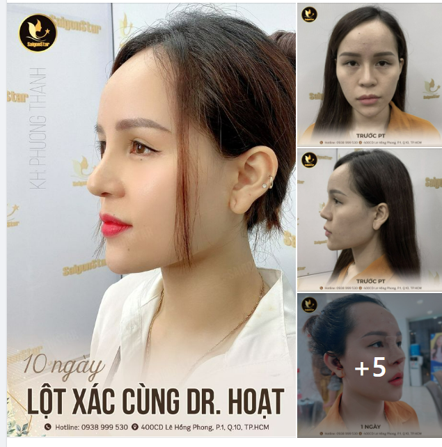 10 NGÀY LỘT XÁC CÙNG DR. HOẠT