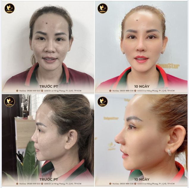 10 NGÀY THĂNG HẠNG NHAN SẮC CỦA NÀNG KIM THOA️