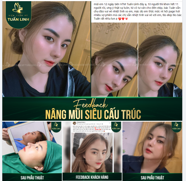 10 NGƯỜI GẶP HẾT 11 NGƯỜI KHEN MŨI EM ĐẸP