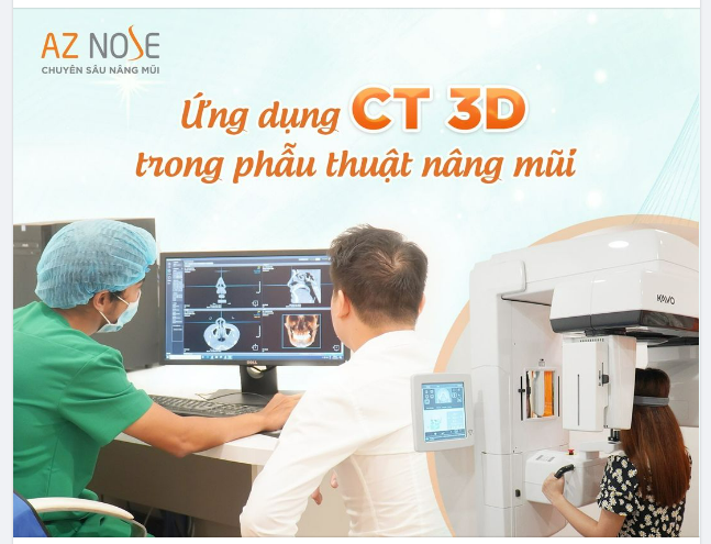 3 LỢI ÍCH KHI CHỤP CT 3D TRƯỚC NÂNG MŨI