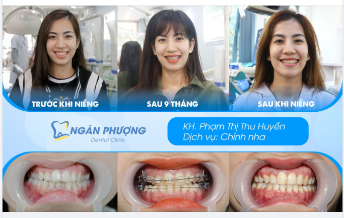 30 chưa phải là Tết- Sở hữu nụ cười chuẩn mực chưa bao giờ là muộn