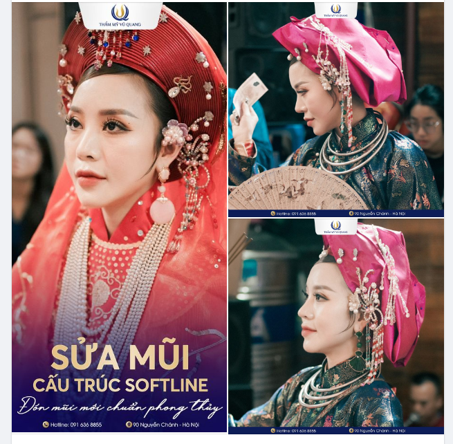 6 LẦN THẨM MỸ MỚI CÓ DÁNG MŨI NÀY - Bạn tin không