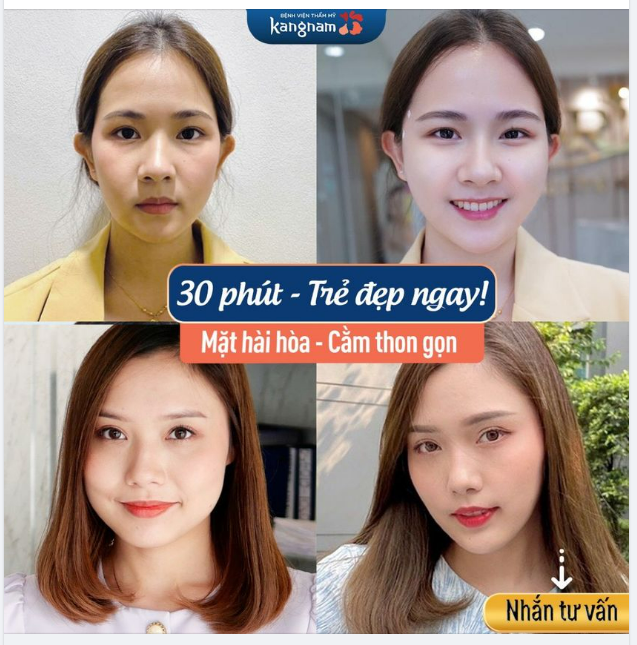 Ai Cũng Hỏi Làm Gì Mà Xinh Thế Tôi Mạnh Dạn Muốn Trẻ Đẹp, Cân Chỉnh