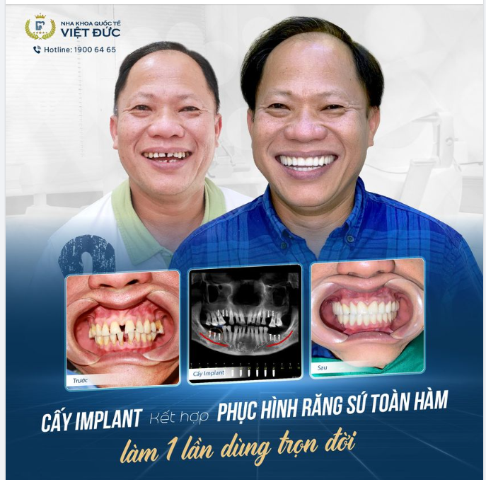 ĂN NHAI BỀN TỐT, CHẮC KHỎE TRỌN ĐỜI