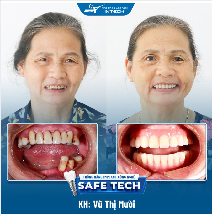 ĂN NHAI THOẢI MÁI - VUI HƯỞNG TUỔI GIÀ