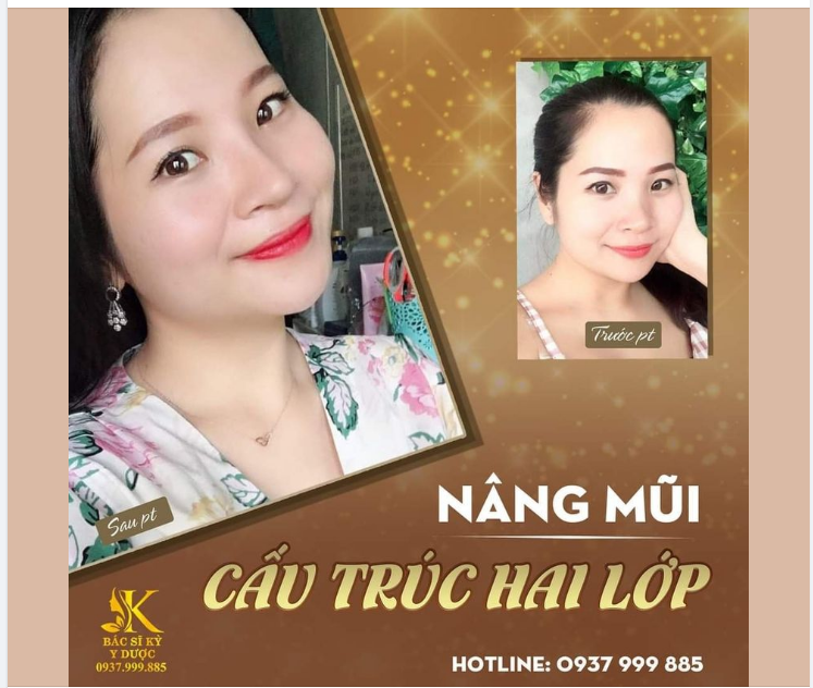 Bạn đã sẵn sàng thay đổi để xinh đẹp hơn chưa