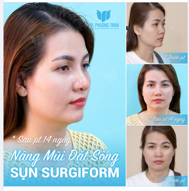 Bỏ lỡ bình minh, có thể ngắm vào mai. Bỏ lỡ em, chắc chắn không có lần hai...!