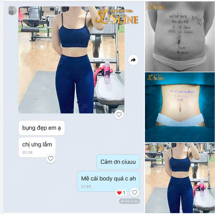 “Bụng đẹp lắm, em ưng lắm ạ”
