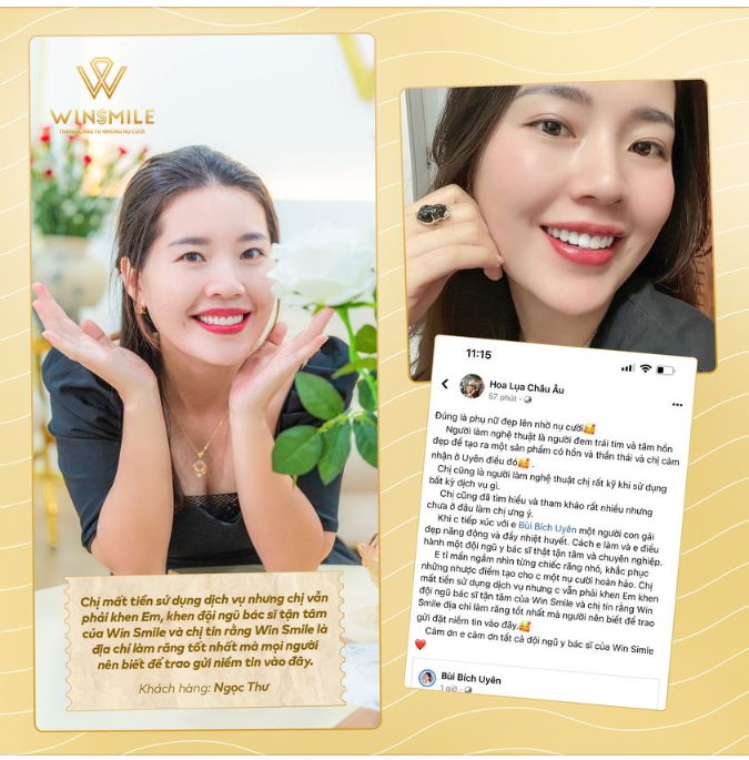 Cảm nhận sau khi sử dụng dịch vụ thẩm mỹ răng sứ của chị Nguyễn N.Thư gửi đến Win Smile đã thực sự làm lay động trái tim của toàn bộ đội ngũ.