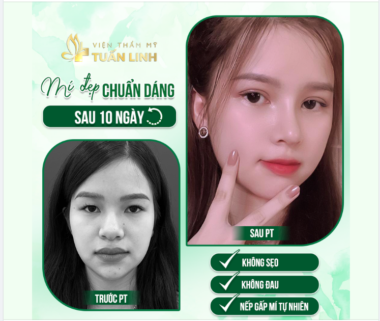 CẮT MÍ - ĐẸP TỰ NHIÊN NHƯ CHƯA HỀ THẨM MỸ